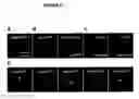 Fig. 04 - Functional Targeted Brain Endoskeletonization