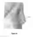 Fig. 09 - System for smoothing 3D clouds