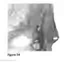 Fig. 15 - System for smoothing 3D clouds