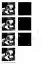 Fig. 09 - Method and apparatus for multiple image registration in the gradient domain
