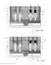 Fig. 09 - Vertical junction FinFET device and method for manufacture