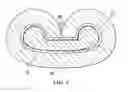 Fig. 05 - WIRE AND METHODS FOR PREPARING A WIRE TO RECEIVE A CONTACT ELEMENT
