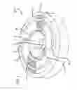Fig. 02 - Flexture-Type Strain Relief Device