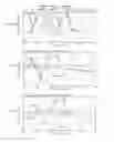 Fig. 07 - Variable-frequency filter
