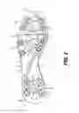 Fig. 03 - Article of footwear having ground surface material accumulation prevention structure