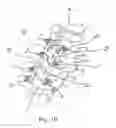 Fig. 06 - Method and system for trans-lamina spinal fixation