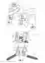 Fig. 02 - Translaminar interspinous stabilization system