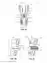 Fig. 06 - Translaminar interspinous stabilization system