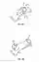 Fig. 07 - Lamina implants and methods for spinal decompression