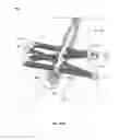 Fig. 35 - Lockable intramedullary fixation device