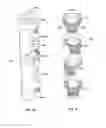Fig. 37 - Lockable intramedullary fixation device