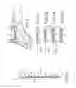 Fig. 02 - Metacarpal bone stabilization device