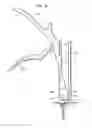 Fig. 09 - Tether tensioning instrument