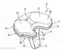 Fig. 01 - Tibial implant for knee prosthesis
