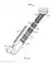 Fig. 07 - Torsionally Stabilized Endoprosthetic Device