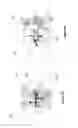 Fig. 06 - FLEXIBLE SPINAL FIXATION DEVICE