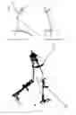 Fig. 02 - Prosthetic joints