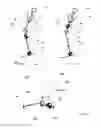 Fig. 07 - Prosthetic joints
