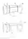 Fig. 06 - Removable and Adjustable Cast