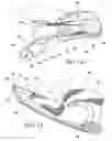 Fig. 09 - Hand support and method for using the same