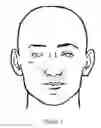 Fig. 02 - Nasal compression device