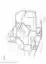 Fig. 02 - Arm support for supine patient