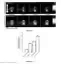 Fig. 09 - Cavitation-inducing polymeric nanoparticles