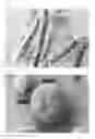 Fig. 01 - Therapeutic agents and delivery with microspheres