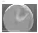 Fig. 02 - Therapeutic agents and delivery with microspheres