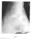 Fig. 04 - Topical medications for bruises and burns