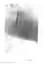 Fig. 06 - Topical medications for bruises and burns