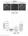 Fig. 02 - Methods and Compositions for the Treatment of Proteinuric Diseases