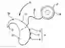 Fig. 01 - Hearing prosthesis system having interchangeable housings