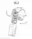 Fig. 06 - Hearing prosthesis system having interchangeable housings