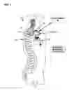 Fig. 02 - Selection of spinal cord stimulation electrodes for use in cardiac therapy