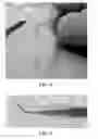 Fig. 07 - A DEVICE FOR DISPENSING A COMPOSITION AND METHODS OF DISPENSING A COMPOSITION