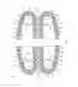 Fig. 02 - Drawing assembly for drawing machines, provided with intermediate chains, and method for tensioning said intermediate chains