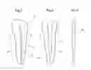 Fig. 02 - ENDODONTIC POST SYSTEM