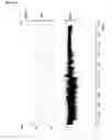 Fig. 02 - METALLOCENE CATALYST SYSTEM COMPRISING ANTISTATIC AGENT AND METHOD FOR PREPARING POLYOLEFIN USING THE SAME