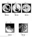 Fig. 04 - Aqueous retarded acid solution and methods for use thereof