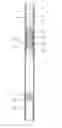 Fig. 01 - Activating tool for displacing of a component in a well tube and method for adjusting the activating tool