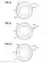 Fig. 09 - Fluid pump with radial bearing between inner rotor and rotary shaft and lubrication groove in outer peripheral surface of radial bearing