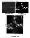 Fig. 18 - Raman scattering nanoprobes