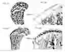 Fig. 02 - Methods for diagnosing osteoarthritis
