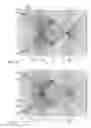 Fig. 12 - Tomographic processing for touch detection