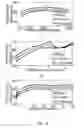Fig. 09 - SENSING NON-SPEECH BODY SOUNDS
