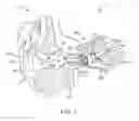 Fig. 02 - Anatomically customized ear canal hearing apparatus