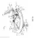 Fig. 03 - Anatomically customized ear canal hearing apparatus