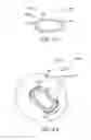Fig. 08 - Anatomically customized ear canal hearing apparatus