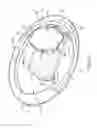 Fig. 14 - Anatomically customized ear canal hearing apparatus